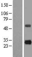 HSCB Human Over-expression Lysate