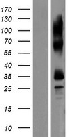 TEDDM1 Human Over-expression Lysate