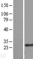 RAB39B Human Over-expression Lysate