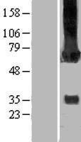 CAMK2G Human Over-expression Lysate