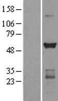 CAMK2G Human Over-expression Lysate