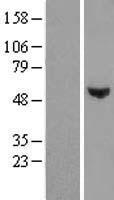 WDR51B (POC1B) Human Over-expression Lysate