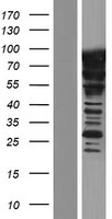 SF4 (SUGP1) Human Over-expression Lysate