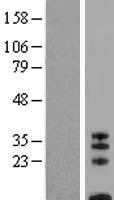 CD8B Human Over-expression Lysate