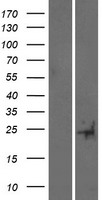 TRARG1 Human Over-expression Lysate