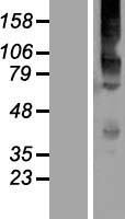 KCNG4 Human Over-expression Lysate