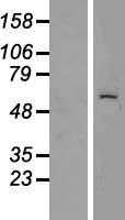 Cytokeratin 6C (KRT6C) Human Over-expression Lysate