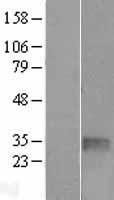 TGIF (TGIF1) Human Over-expression Lysate