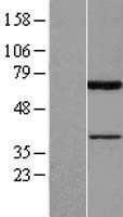 PIAS2 Human Over-expression Lysate