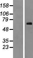 NOR1 (NR4A3) Human Over-expression Lysate