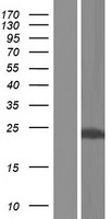KChIP2 (KCNIP2) Human Over-expression Lysate