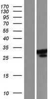 CCDC149 Human Over-expression Lysate