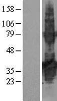 TMEM171 Human Over-expression Lysate