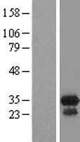 CCDC117 Human Over-expression Lysate
