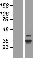ANKRD29 Human Over-expression Lysate