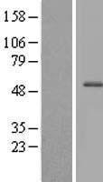 CFAP47 Human Over-expression Lysate