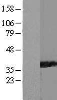PPIL6 Human Over-expression Lysate
