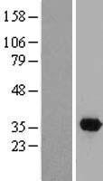 DTWD2 Human Over-expression Lysate