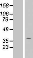 RING finger protein 175 (RNF175) Human Over-expression Lysate
