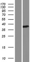 Eph receptor A6 (EPHA6) Human Over-expression Lysate