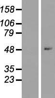 ZNF547 Human Over-expression Lysate