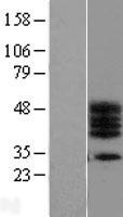 C17orf78 Human Over-expression Lysate