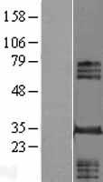 INO80E Human Over-expression Lysate