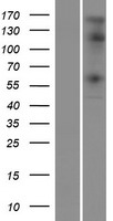 STK32C Human Over-expression Lysate