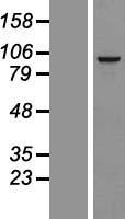 RSPH10B Human Over-expression Lysate