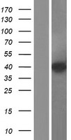 KLHDC8B Human Over-expression Lysate