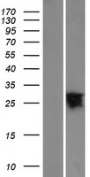 YIPF6 Human Over-expression Lysate