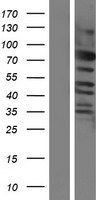 C6ORF182 (CEP57L1) Human Over-expression Lysate