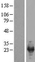 SFRS12IP1 (SREK1IP1) Human Over-expression Lysate