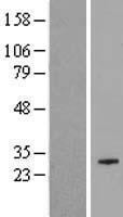 COX18 Human Over-expression Lysate