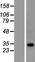 RABL3 Human Over-expression Lysate