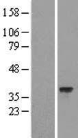 C11ORF77 (HARBI1) Human Over-expression Lysate