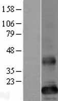 TMEM86B Human Over-expression Lysate