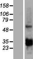 CCDC107 Human Over-expression Lysate
