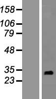 RNF151 Human Over-expression Lysate