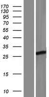 FBXO36 Human Over-expression Lysate