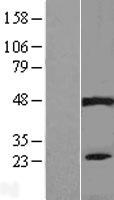 PIP5KL1 Human Over-expression Lysate