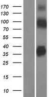 Zinc transporter 8 (SLC30A8) Human Over-expression Lysate