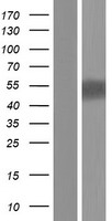 P2X5 (P2RX5) Human Over-expression Lysate