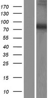 DDX51 Human Over-expression Lysate