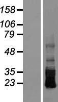 CRB3 Human Over-expression Lysate