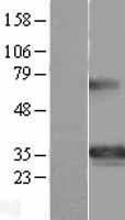 GSC Human Over-expression Lysate