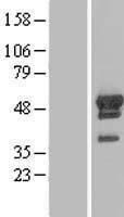 ARFGAP1 Human Over-expression Lysate