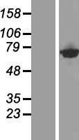 CTPS2 Human Over-expression Lysate