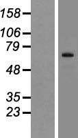 SIX5 Human Over-expression Lysate