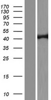 Dnmt2 (TRDMT1) Human Over-expression Lysate